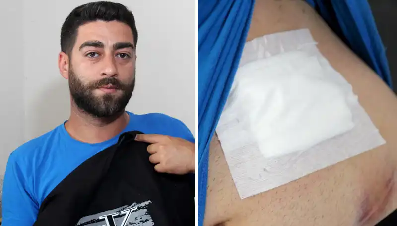 Karnında Hissettiği Ağrının Gerçek Nedeni Röntgende Ortaya Çıktı