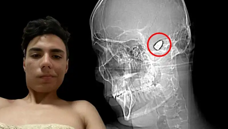 Kafasındaki Bomba ile Gezenlerin Duygu Dünyası: Bir Yolculuk Hikayesi