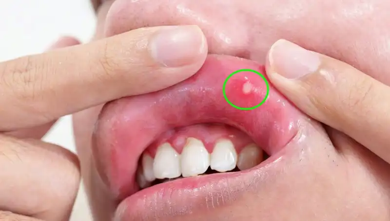 Vücudunuzun İhtiyacı Olan B Vitaminlerini Kaçırıyor Olabilirsiniz!