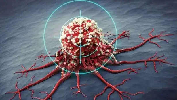 Prostat Kanserine Karşı Mücadelede 6 Güçlü Besin Önerisi