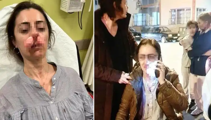 Otomobil Kapısı Silah Olarak Kullanıldı: Eşinin Sevgilisiyle Mücadele Edildi!