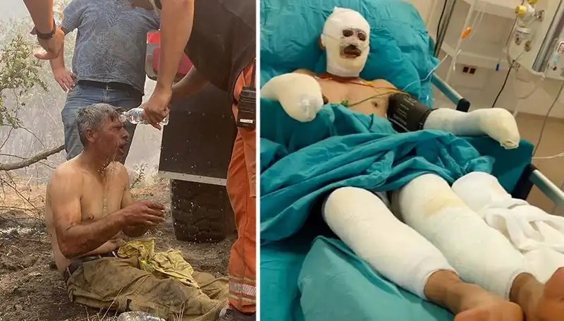 Ormanda Yangınla Mücadele Eden İşçinin Feryadı: "Yanıyorum!"