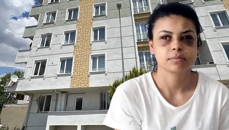 Düğün Töreninde Maganda Dehşeti: Saçmalar Göz Yaraladı