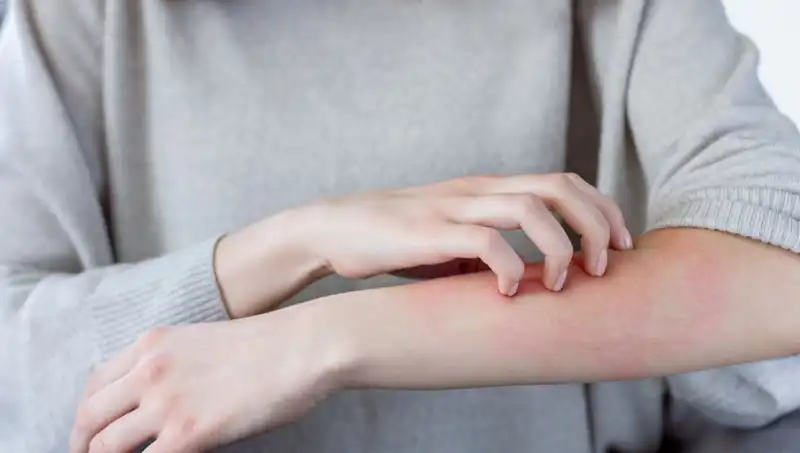 Cilt Kanserinin Gizli Belirtileri: Dermatologdan Kaçırılmaması Gereken İpuçları